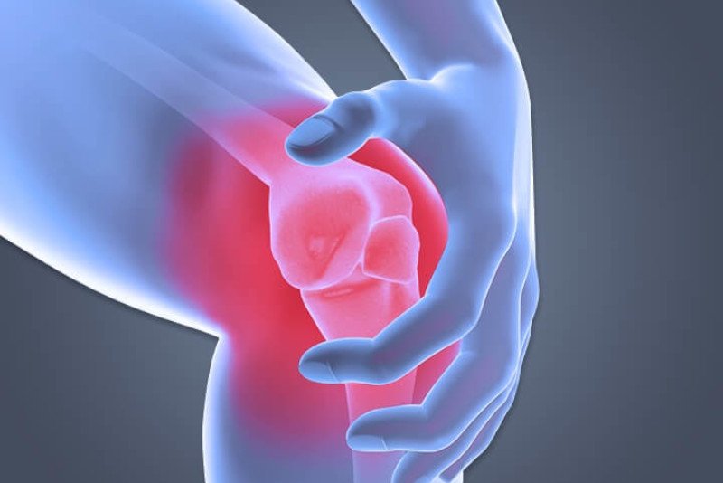 kneePain